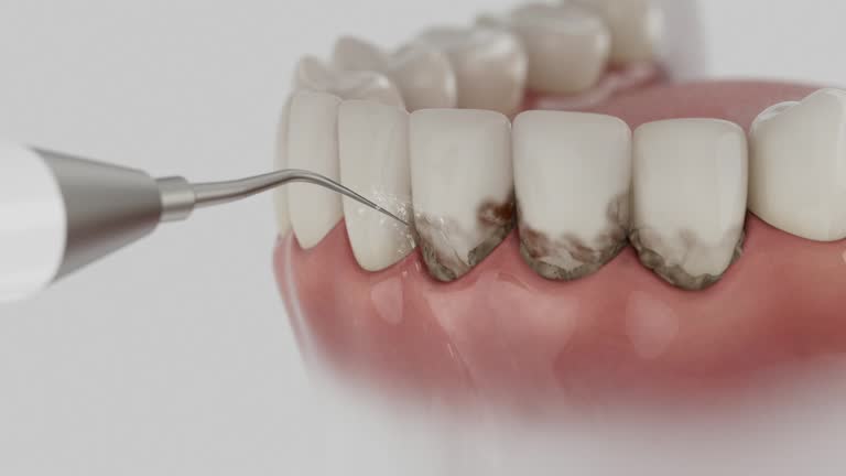 Reliable Dental contractor in St. Paris, OH by Dentist Open Now